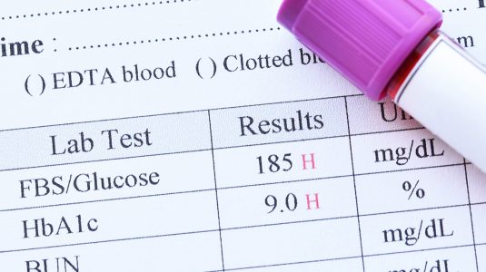 Blood sample with diabetes test results