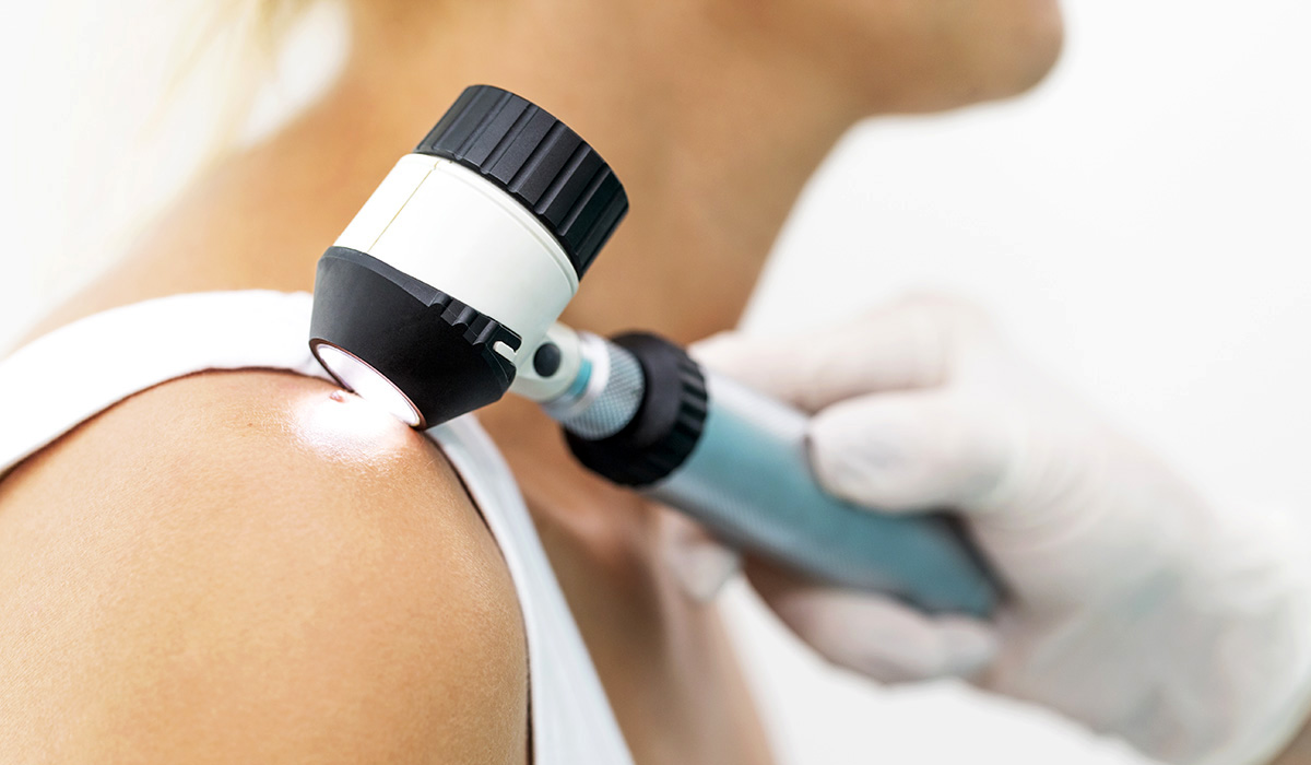 A doctor examining melanoma using dermatoscope