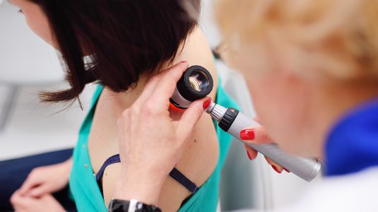 doctor examining birthmarks and moles on a patient